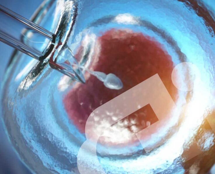 IVF-(In-Vitro-Fertilization)-Treatments IVF-(In-Vitro-Fertilization)-Treatments