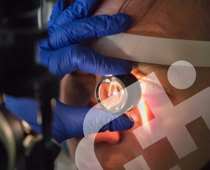 Stem-Cell-Therapy-in-Eye-Diseases Stem-Cell-Therapy-in-Eye-Diseases