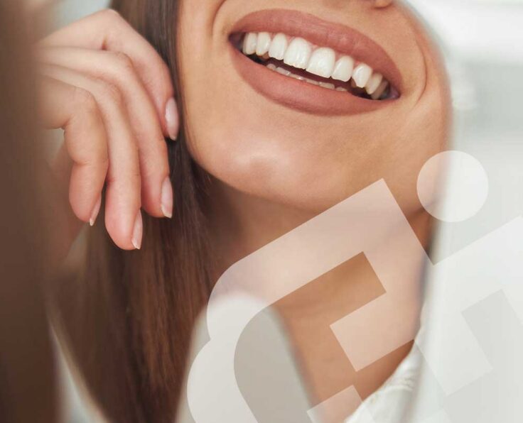 hollywood-smile hollywood-smile