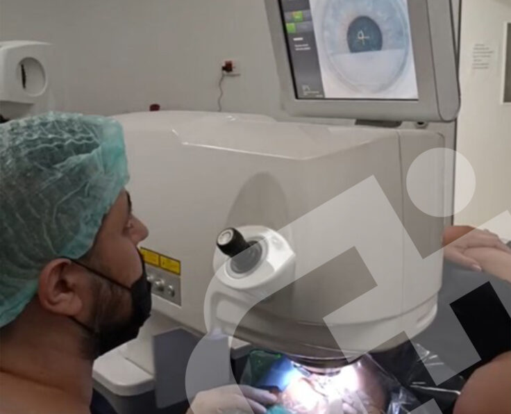 laser-treatment laser-treatment