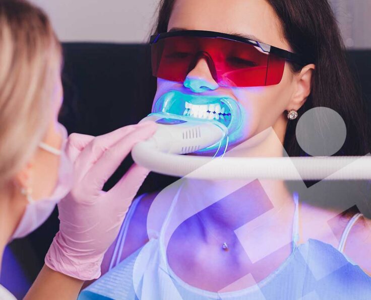 teeth-whitening teeth-whitening